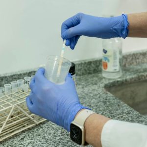 Análisis bioquímico de orina: proceso total del laboratorio